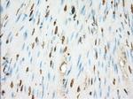 ERCC1 Antibody in Immunohistochemistry (Paraffin) (IHC (P))