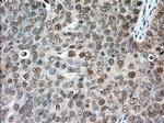 ERCC1 Antibody in Immunohistochemistry (Paraffin) (IHC (P))