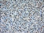 ERCC1 Antibody in Immunohistochemistry (Paraffin) (IHC (P))