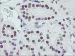 ERCC1 Antibody in Immunohistochemistry (Paraffin) (IHC (P))