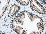 ERCC1 Antibody in Immunohistochemistry (Paraffin) (IHC (P))