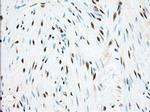 ERCC1 Antibody in Immunohistochemistry (Paraffin) (IHC (P))