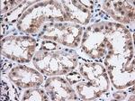 ERCC1 Antibody in Immunohistochemistry (Paraffin) (IHC (P))