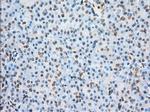 ERCC1 Antibody in Immunohistochemistry (Paraffin) (IHC (P))