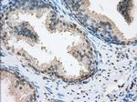 ERCC1 Antibody in Immunohistochemistry (Paraffin) (IHC (P))