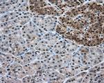 ERCC1 Antibody in Immunohistochemistry (Paraffin) (IHC (P))