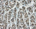 ERCC1 Antibody in Immunohistochemistry (Paraffin) (IHC (P))