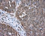 ERCC1 Antibody in Immunohistochemistry (Paraffin) (IHC (P))