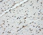 ERCC1 Antibody in Immunohistochemistry (Paraffin) (IHC (P))