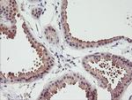 ERCC1 Antibody in Immunohistochemistry (Paraffin) (IHC (P))