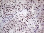 ERCC1 Antibody in Immunohistochemistry (Paraffin) (IHC (P))