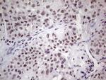 ERCC1 Antibody in Immunohistochemistry (Paraffin) (IHC (P))