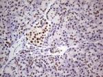 ERCC1 Antibody in Immunohistochemistry (Paraffin) (IHC (P))