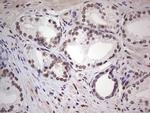 ERCC1 Antibody in Immunohistochemistry (Paraffin) (IHC (P))