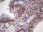 ERCC1 Antibody in Immunohistochemistry (Paraffin) (IHC (P))