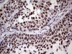 ERCC1 Antibody in Immunohistochemistry (Paraffin) (IHC (P))