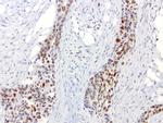 ERCC1 Antibody in Immunohistochemistry (Paraffin) (IHC (P))