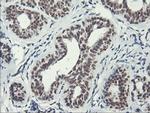 ERCC1 Antibody in Immunohistochemistry (Paraffin) (IHC (P))