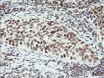 ERCC1 Antibody in Immunohistochemistry (Paraffin) (IHC (P))