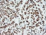 ERCC1 Antibody in Immunohistochemistry (Paraffin) (IHC (P))