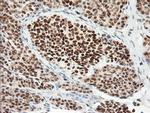 ERCC1 Antibody in Immunohistochemistry (Paraffin) (IHC (P))