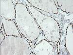 ERCC1 Antibody in Immunohistochemistry (Paraffin) (IHC (P))