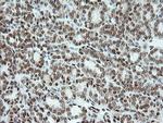 ERCC1 Antibody in Immunohistochemistry (Paraffin) (IHC (P))