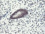 ERCC1 Antibody in Immunohistochemistry (Paraffin) (IHC (P))