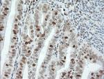 ERCC1 Antibody in Immunohistochemistry (Paraffin) (IHC (P))