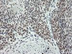 ERCC1 Antibody in Immunohistochemistry (Paraffin) (IHC (P))