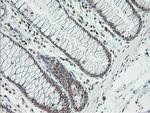 ERCC1 Antibody in Immunohistochemistry (Paraffin) (IHC (P))