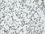 ERCC1 Antibody in Immunohistochemistry (Paraffin) (IHC (P))