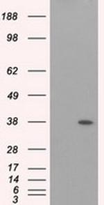 ERCC1 Antibody in Western Blot (WB)