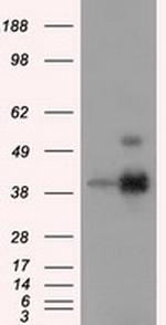 ERCC1 Antibody in Western Blot (WB)