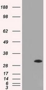 ERCC1 Antibody in Western Blot (WB)