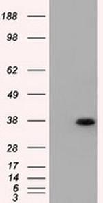 ERCC1 Antibody in Western Blot (WB)