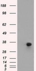 ERCC1 Antibody in Western Blot (WB)