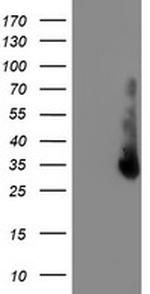 ERCC1 Antibody in Western Blot (WB)