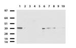 ERCC1 Antibody in Western Blot (WB)