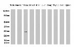 ERCC1 Antibody in Western Blot (WB)