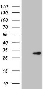 ERCC2 Antibody in Western Blot (WB)