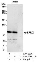 ERCC3 Antibody in Immunoprecipitation (IP)