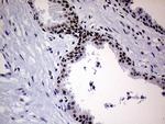 ERCC3 Antibody in Immunohistochemistry (Paraffin) (IHC (P))