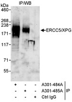 ERCC5/XPG Antibody in Immunoprecipitation (IP)