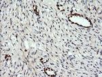 ERG Antibody in Immunohistochemistry (Paraffin) (IHC (P))