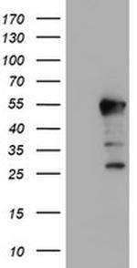 ERI1 Antibody in Western Blot (WB)