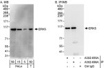 ERK5 Antibody in Western Blot (WB)