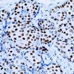 Estrogen Receptor alpha Antibody in Immunohistochemistry (Paraffin) (IHC (P))