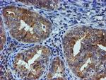 ESR1 Antibody in Immunohistochemistry (Paraffin) (IHC (P))