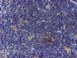 ESR1 Antibody in Immunohistochemistry (Paraffin) (IHC (P))